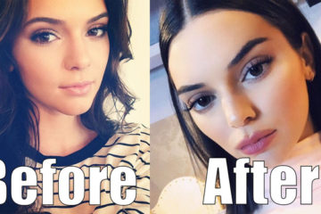 Kendall Jenner TOTALLY Just got Plastic Surgery! She looks Completely Different!